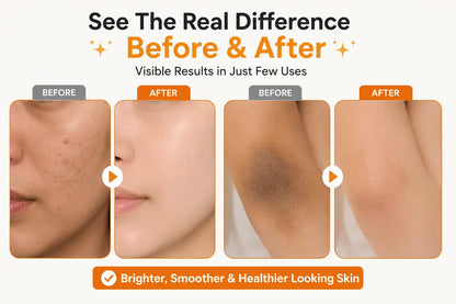Orange Exfoliating Whitening Gel – Dark Spot & Dead Skin Remover