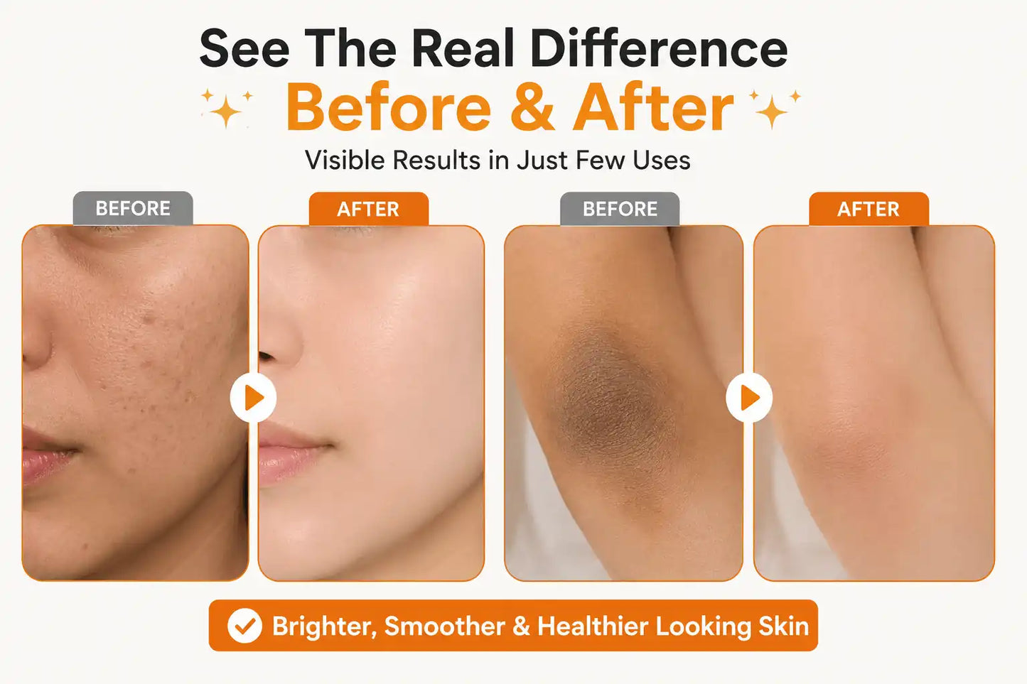 Orange Exfoliating Whitening Gel – Dark Spot & Dead Skin Remover